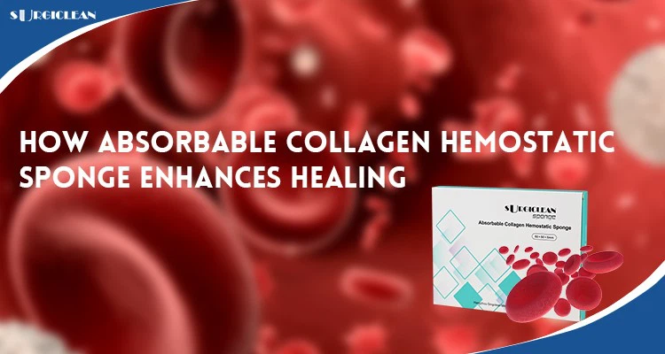 How-Absorbable-Collagen-Hemostatic-Sponge-Enhances-Healing How-Absorbable-Collagen-Hemostatic-Sponge-Enhances-Healing