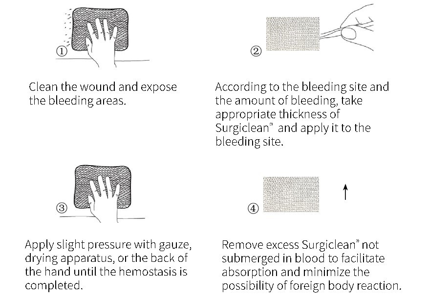 Surgiclean Absorbable oxidied Hemostatic gauze Introduction Surgiclean Absorbable oxidied Hemostatic gauze Introduction