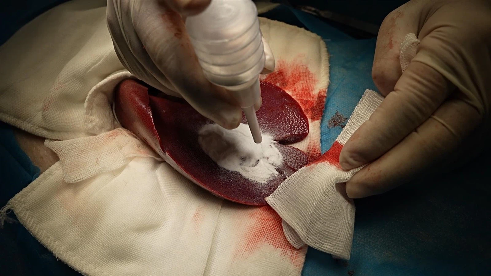 Hemostatic-Powder Hemostatic-Powder